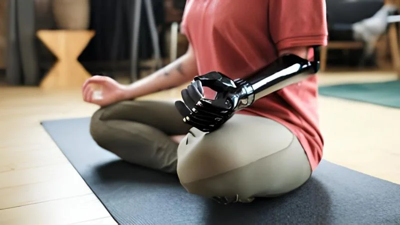 Life after amputation