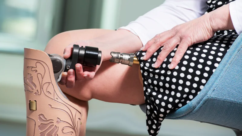 Остеоинтеграция