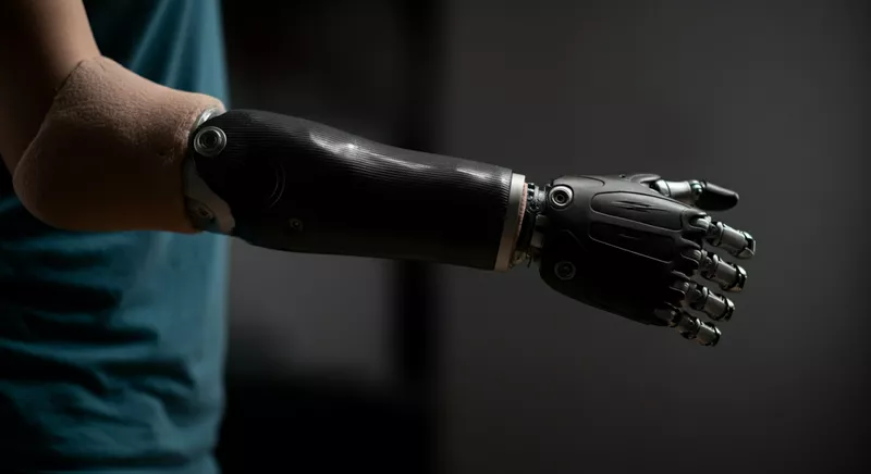 Протез руки