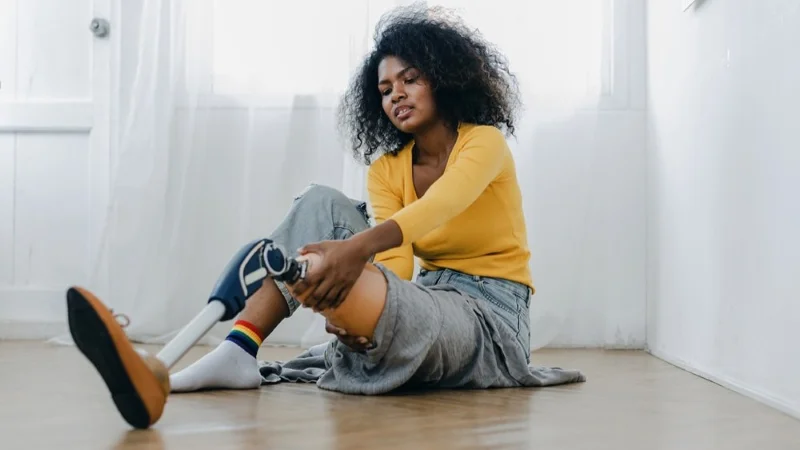 Девушка с протезом ноги