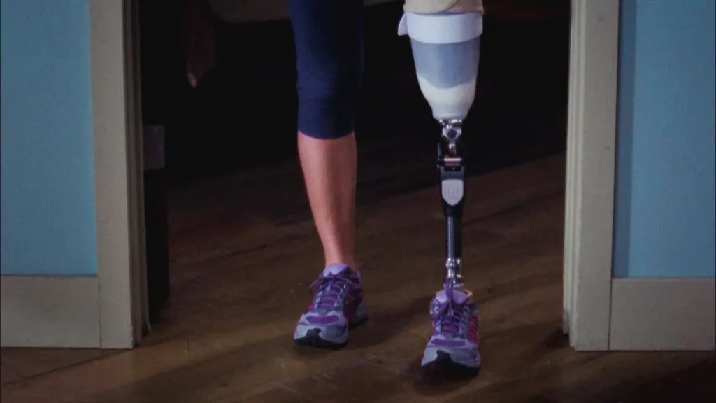 Arizona's amputated leg.