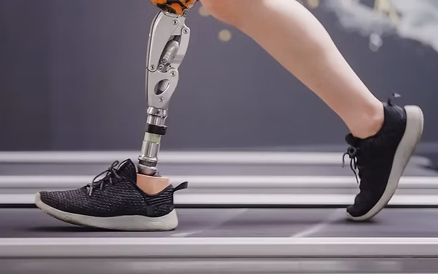 Бионический протез ноги