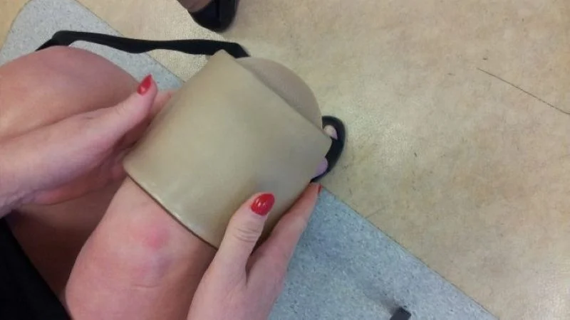 Уход за кожей и гигиена после ампутации