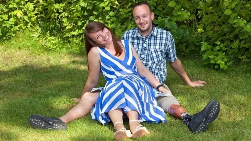 Как ампутация влияет на отношения: честные истории партнёров