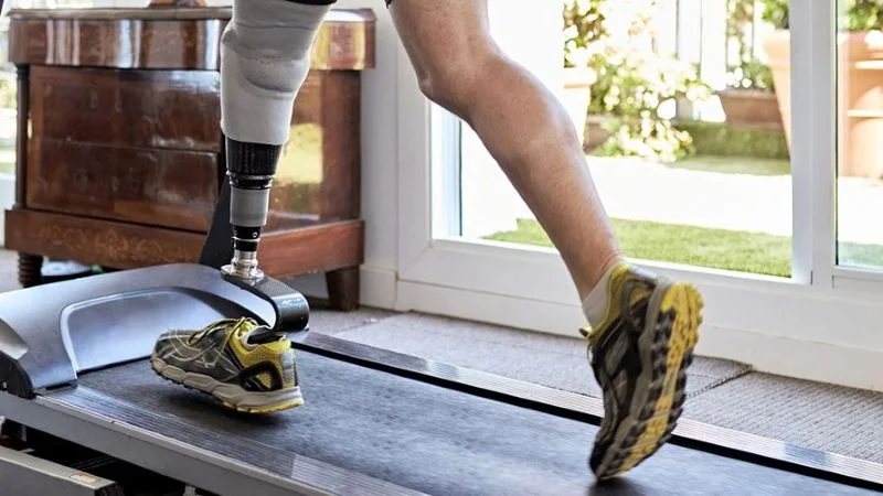 Жизнь после ампутации нижней конечности