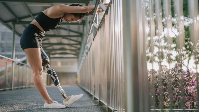 Девушка с бионическим протезом