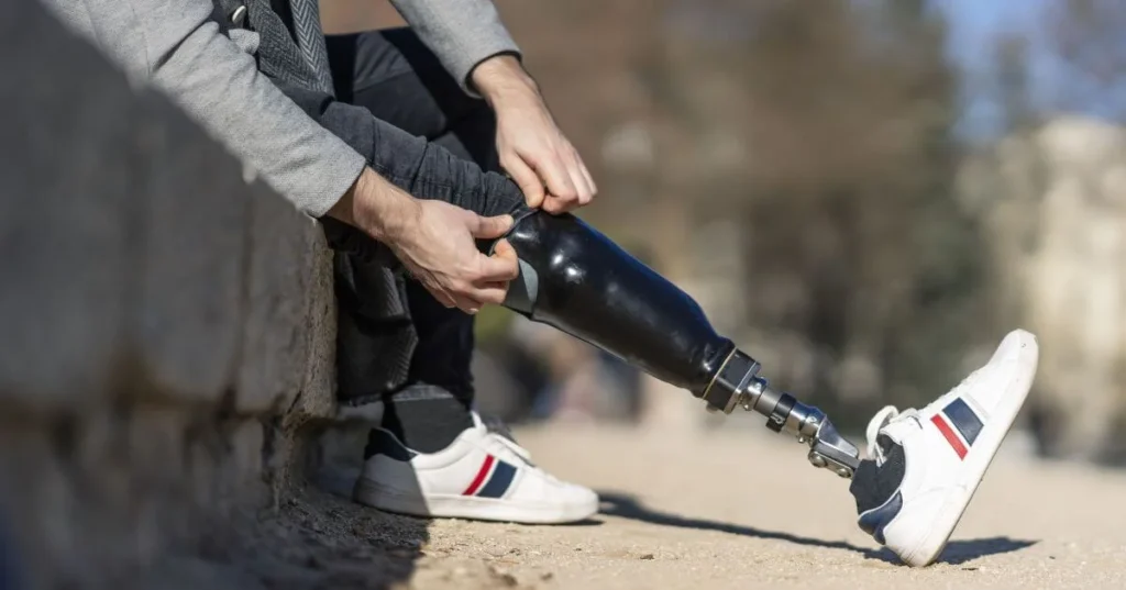 Мужчина с протезом ноги сидит