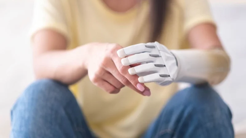 Крупным планом две руки женщины с бионической рукой, человек потерял руку, девушка с искусственным протезом конечности