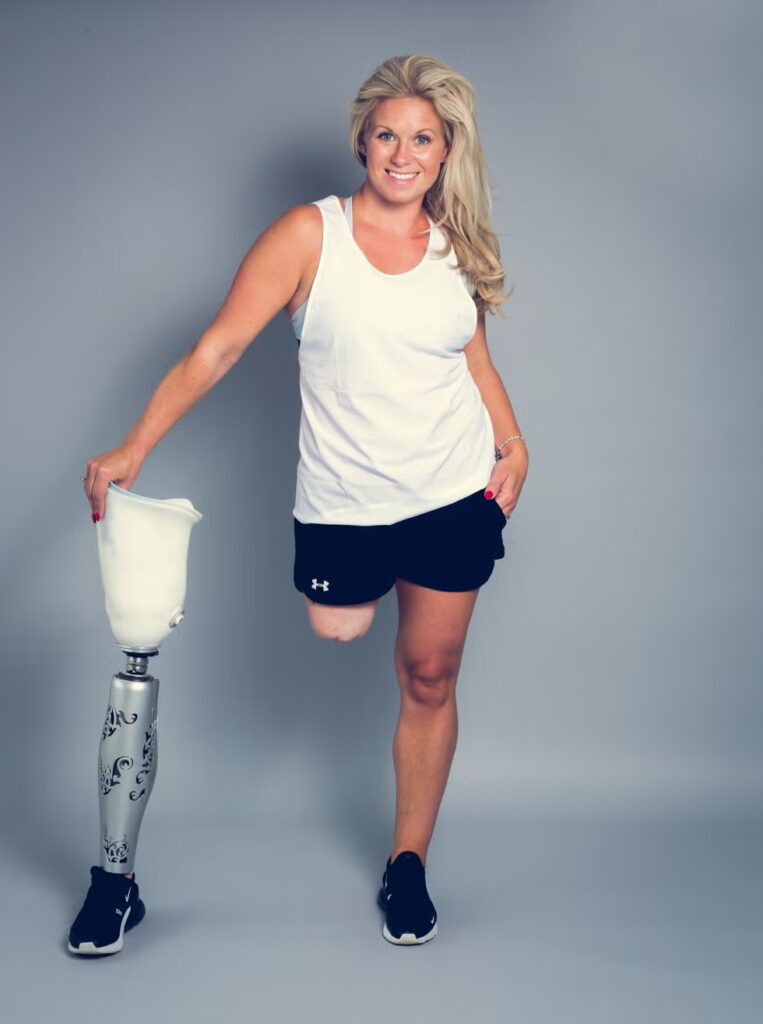 Ампутантка Лиэнн Форрест