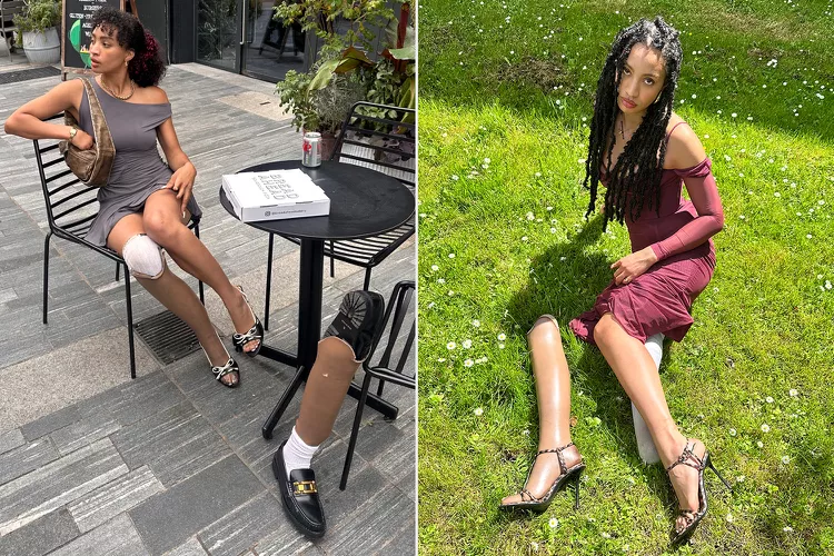 Модель Лирик Херд демонстрирует свой протез ноги