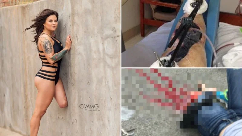 Потеряла ногу, но стала моделью