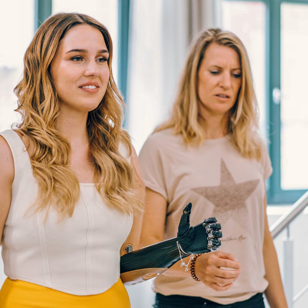 Жизнь с ампутацией руки