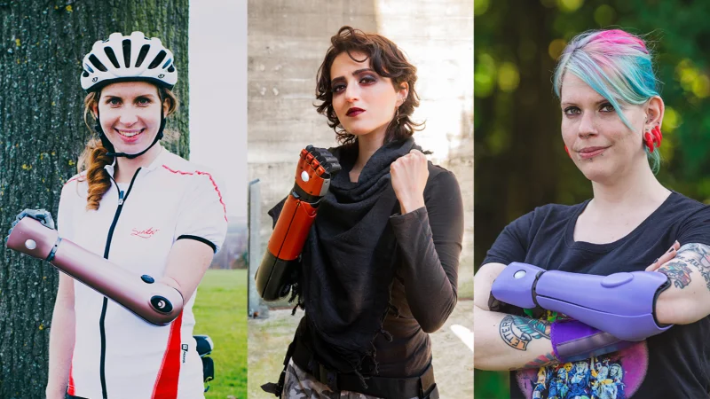 Не просто протез: как технологии и дизайн делают протезы стилем жизни