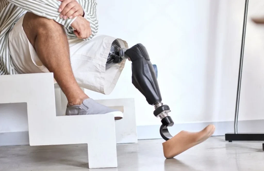 Бионический протез ноги