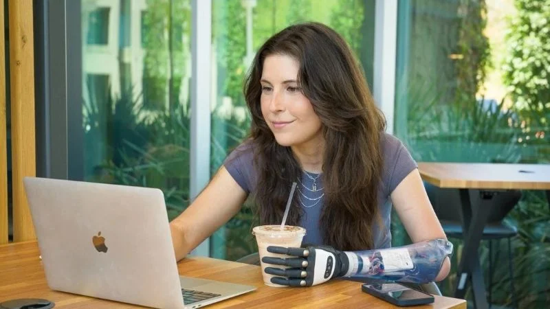 Бионический протез руки