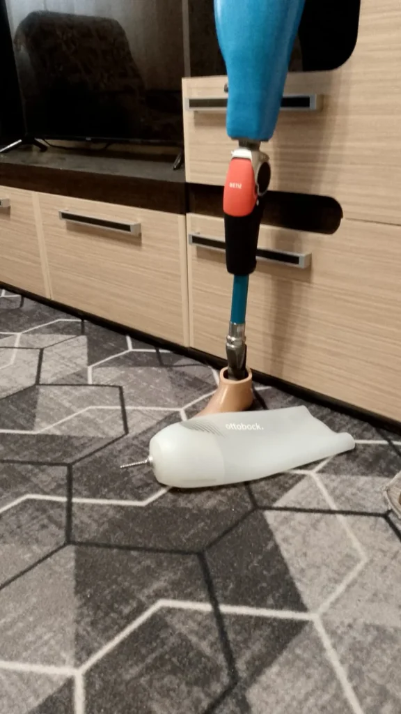 Протез бедра с гидравлическим коленом (влагостойкий, правый)