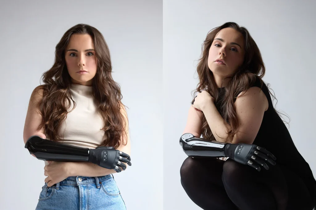 Бионический протез руки