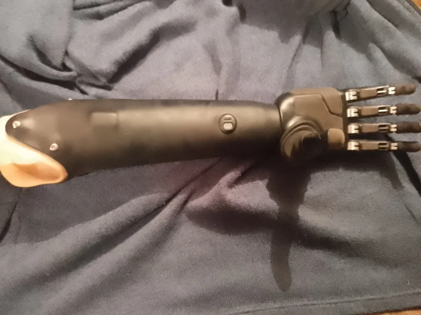 Протез правой руки